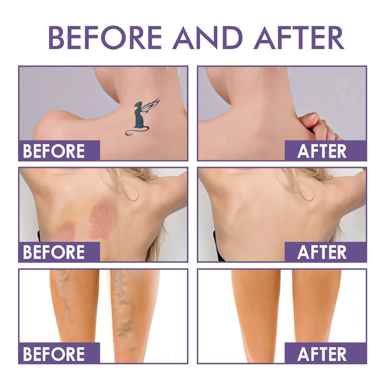 Body Perfector - Image 4